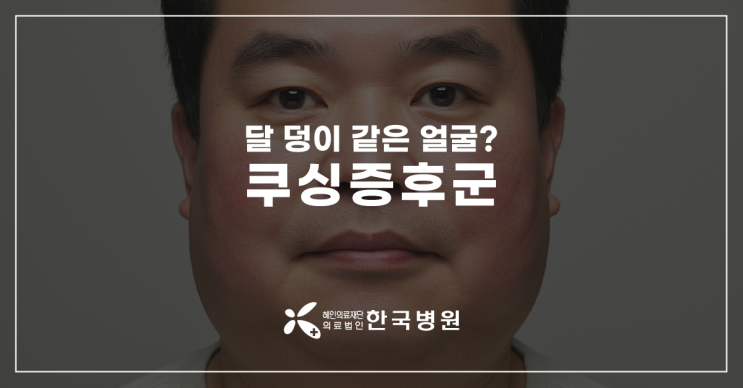  제주 내과_뱃살에 얼굴살 고민? 비만 아닌 '쿠싱증후군'일 수도!