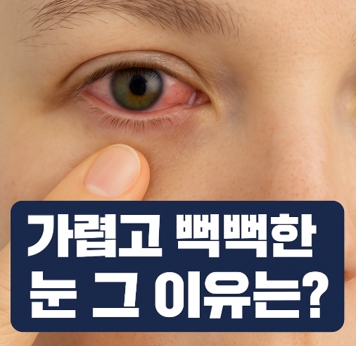  안검염 다래끼 차이 증상 원인 치료 약 항생제 알아봐요