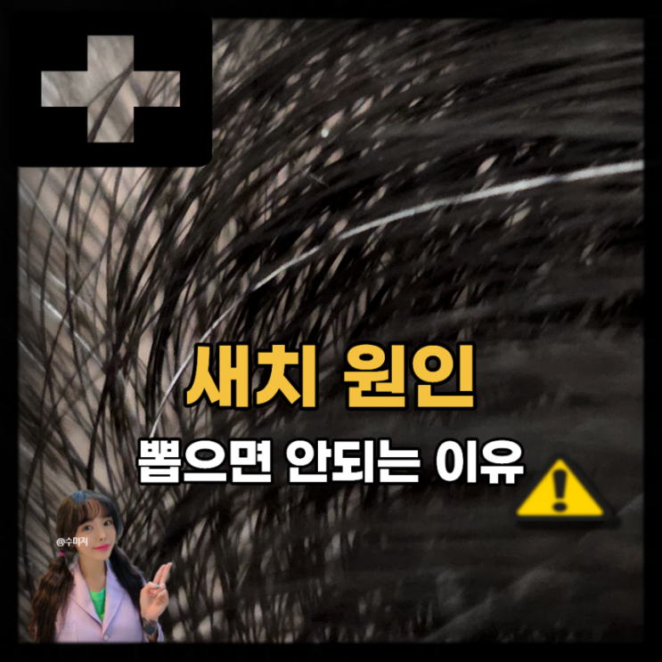  새치 원인, 흰머리 나는 이유, 뽑으면?
