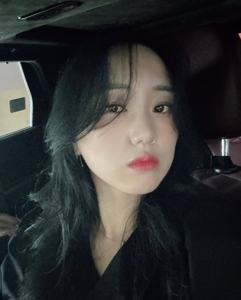 여자탈모 로게인폼 사용기 ~11개월, 두피에 바르는 탈모약 비교 로게인폼과 마이딜 5%