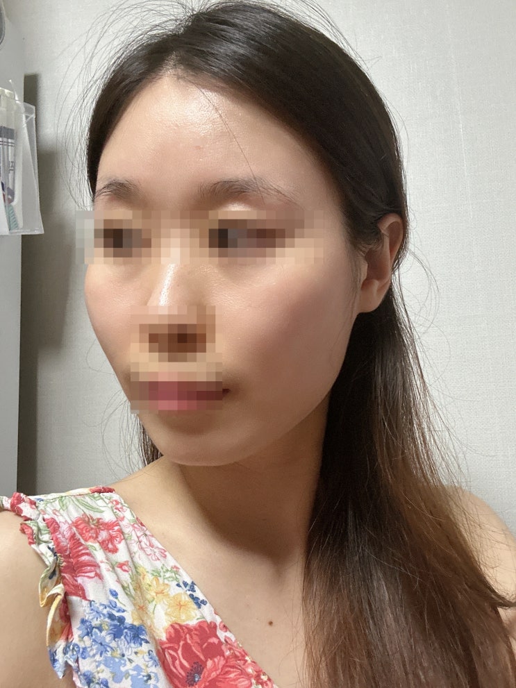  얇은 피부 에센시엘 포텐셀 2번째 사용 솔직후기