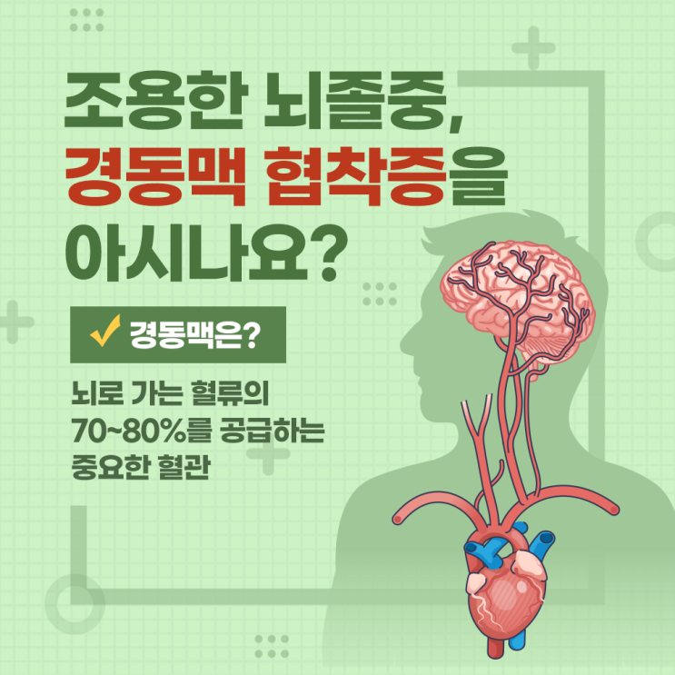  송도건강검진 경동맥 협착증, 조용한 위험 신호를 아시나요?
