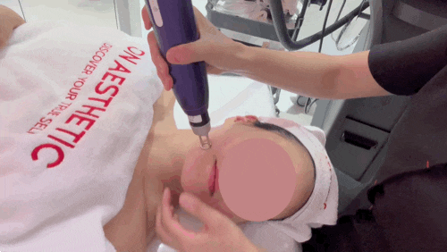  [압구정] 압구정피부관리 ‘온에스테틱 압구정점’ 트라이엄 딥토닝 후기