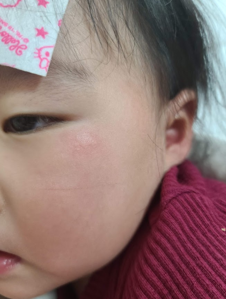  냉방병 증상 몸살 어지러움 목 통증 치료 예방법