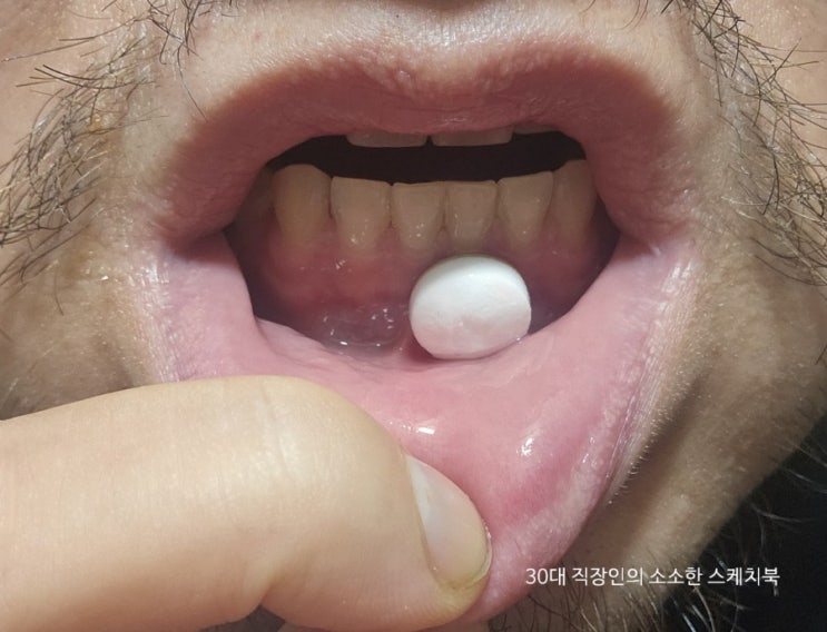  저속노화캔디 자일리톨 저속노화 자일리멜츠 민트프리