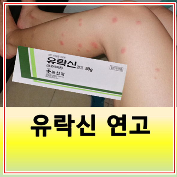 유락신 연고 사용법 가격 부작용 옴진드기 증상