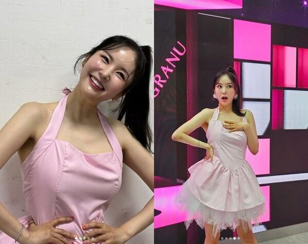  장영란, 4번째 눈성형 후 근황…압도적 미모
