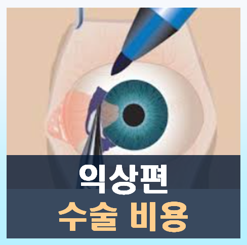익상편 수술비용: 실제 경험을 통한 비용절약 방법