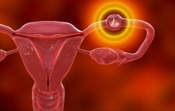 자궁외임신 초기증상부터 원인, 치료, 수술비용까지, 꼭 알아야 할 모든 것
