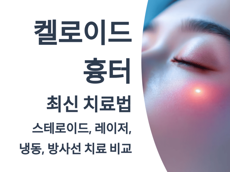  켈로이드 흉터 최신 치료법: 스테로이드, 레이저, 냉동, 방사선 치료 비교
