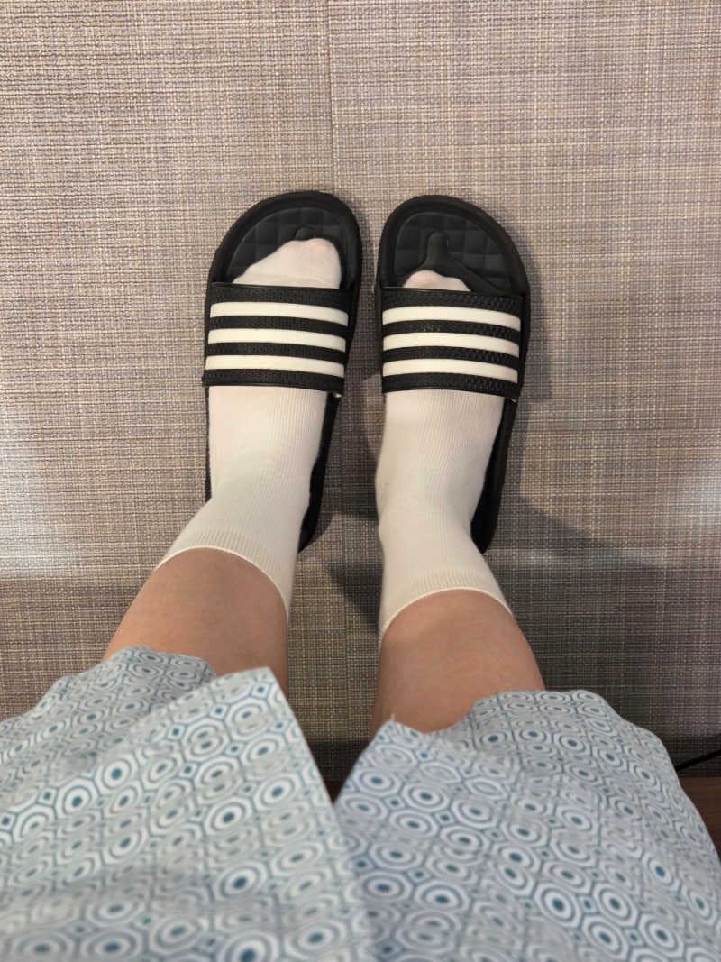 하지정맥류 고주파 수술 후기(검진~3주차 까지)