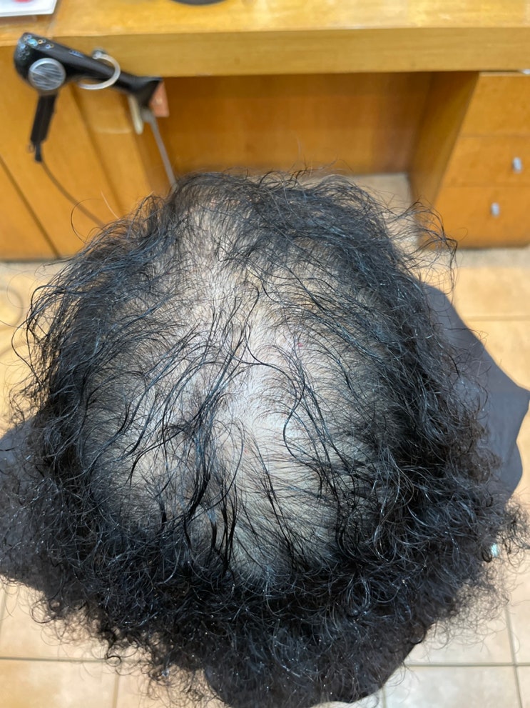  여성탈모 흑채도이제그만 토탈탈모교정펌으로  풍성하게중년여성탈모굿뜨 부산르네헤어/ 사상감전모라하단구포구덕김해동구초량감만남포명지대저에코화명신평영도남천용호대연광안수영망미센텀가야양정동래