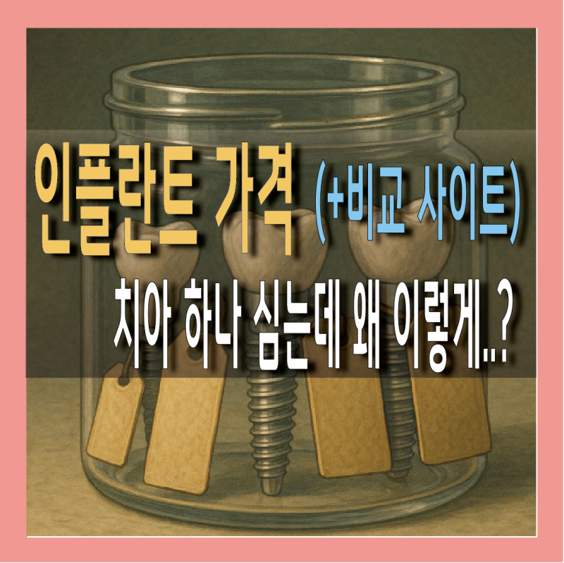 인플란트가격, 앞니 비용 차이 이유 총정리 (비교 사이트)