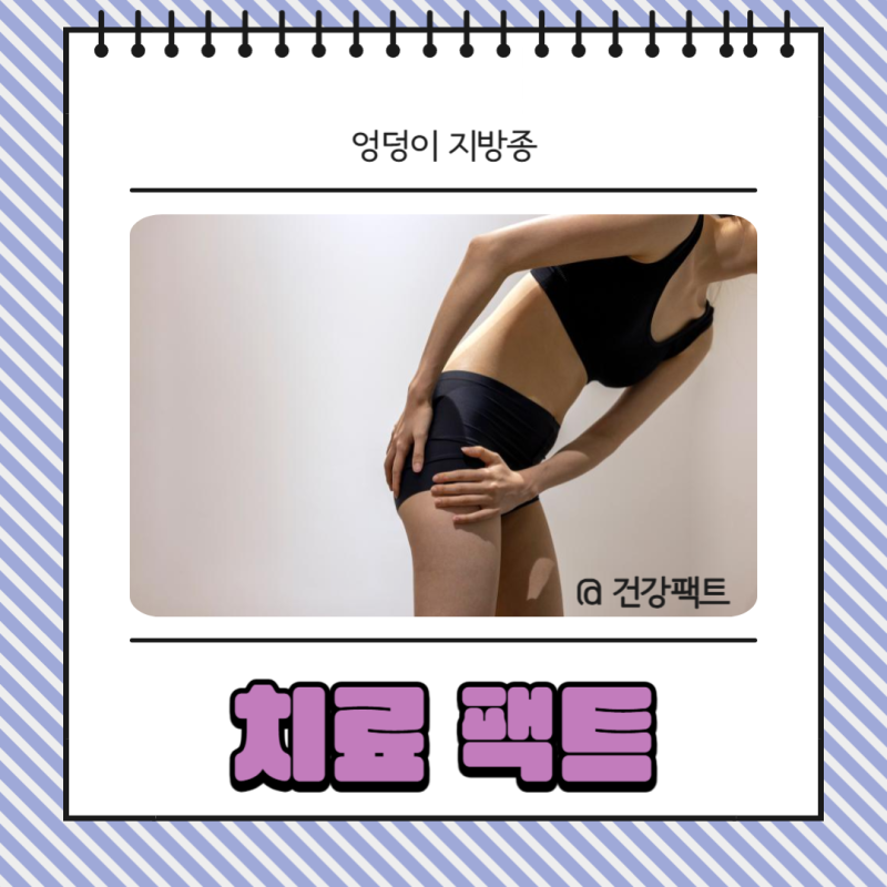 엉덩이 지방종 수술 제거 비용과 후기 정보