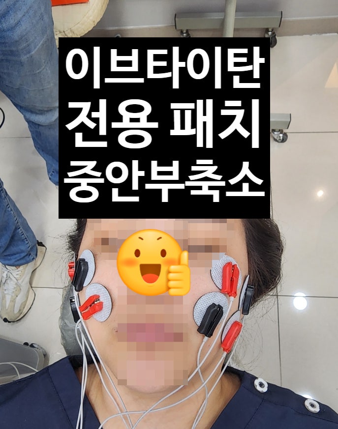  아르네의원 1등 시술 - 이브타이탄 EMS 중안부축소리프팅(청담, 강남 인기) 가격은?