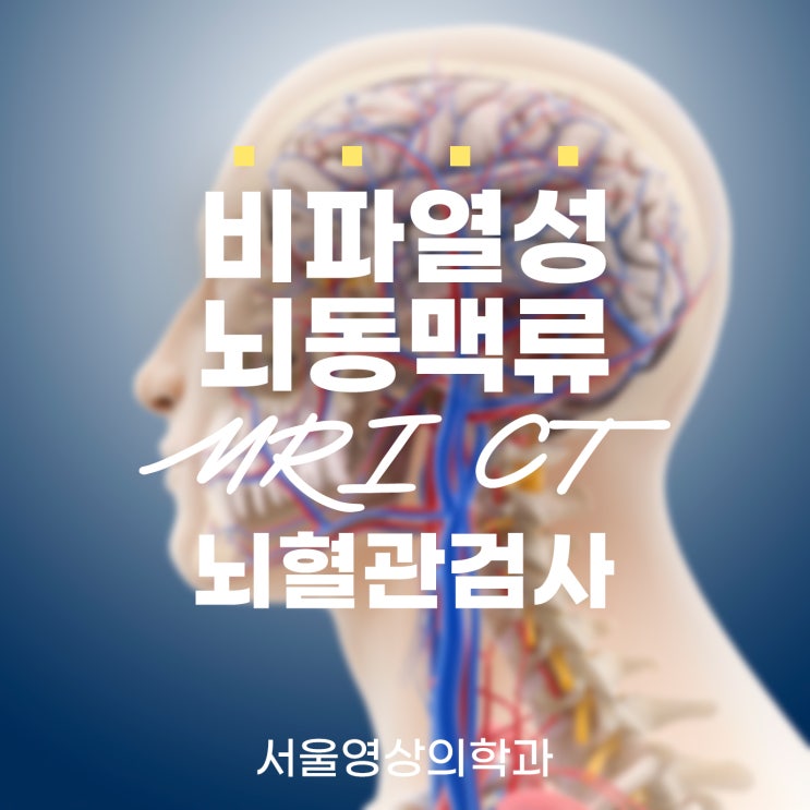  경기광주뇌혈관검사, 비파열성 뇌동맥류 수술 꼭 해야 할까?
