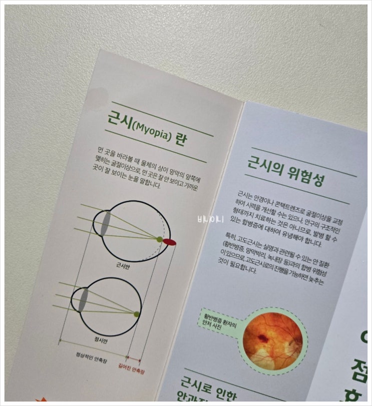  아이 근시 원인부터 예방법까지~ 부모라면 꼭 알아야 할 시력 관리 꿀팁!