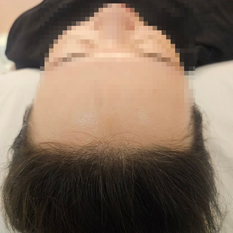  [시스터뷰티 안산고잔점] 이마라인왁싱 만족후기