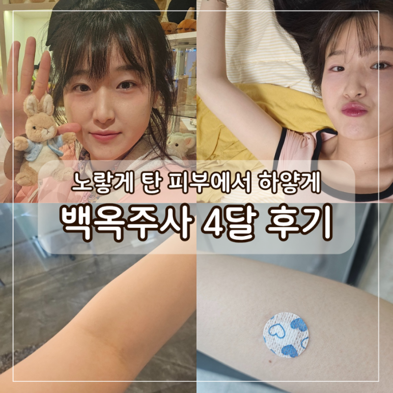 백옥주사 내돈내산 4개월 후기 및 효과