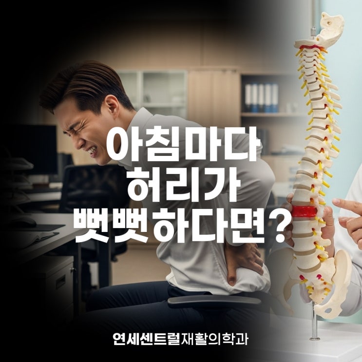  을지로3가역허리통증, 아침마다 허리가 뻣뻣하다면?