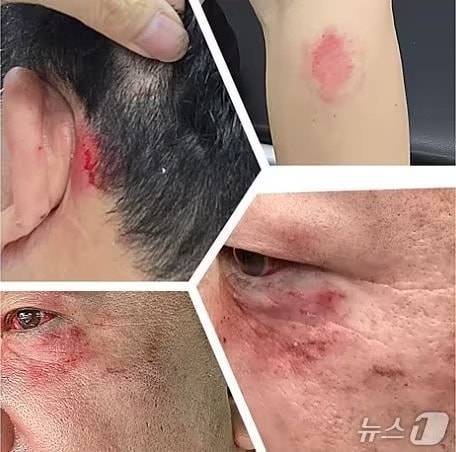  국회의원 측근, 의원 사무실서 화분으로 기자 폭행! 분노조절장애 있다더니... 진실은?