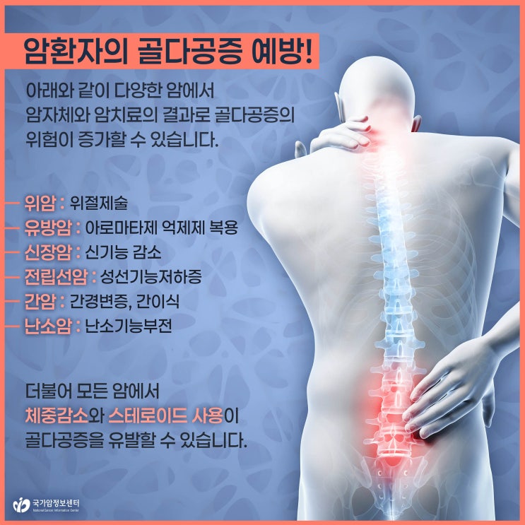  암환자의 골다공증 예방!