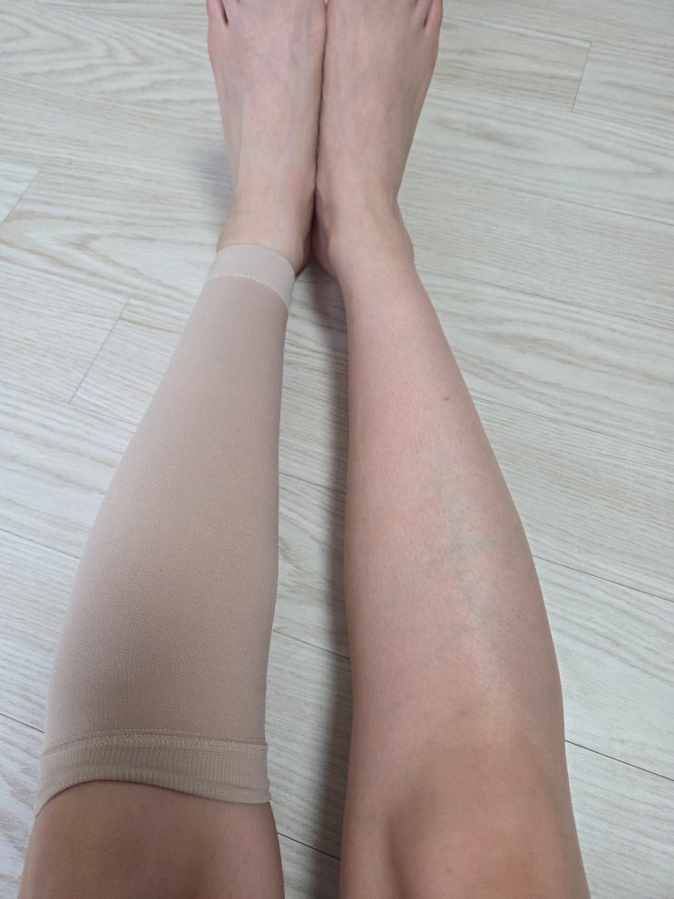  하지정맥류 종아리 압박스타킹 베노프레스, 간호사 압박스타킹 추천