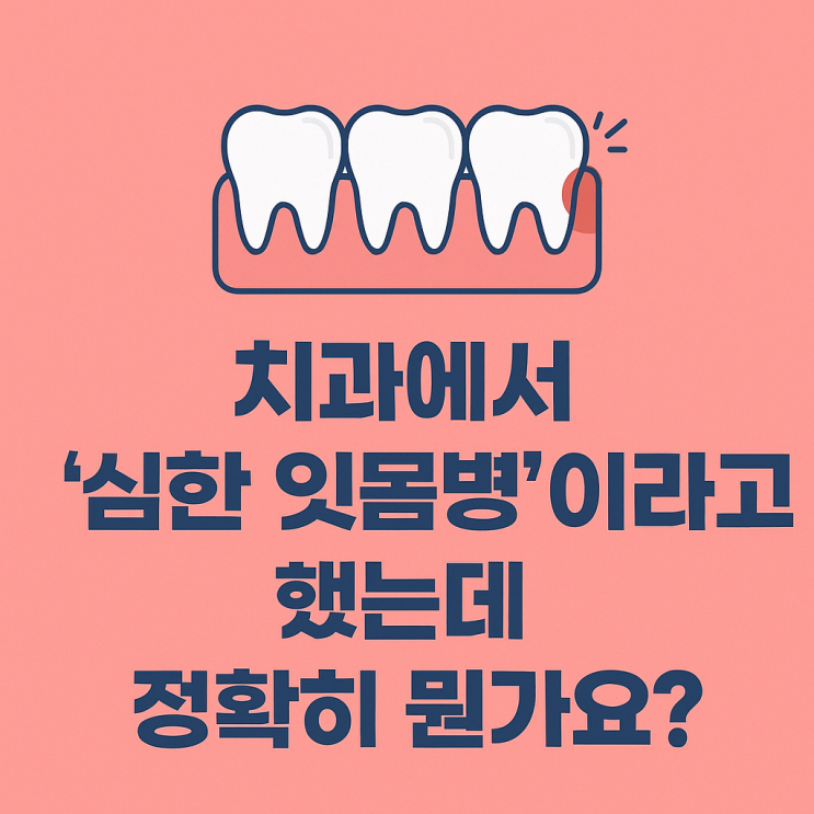   치과에서 ‘심한 잇몸병’이라고 했는데 정확히 뭔가요?