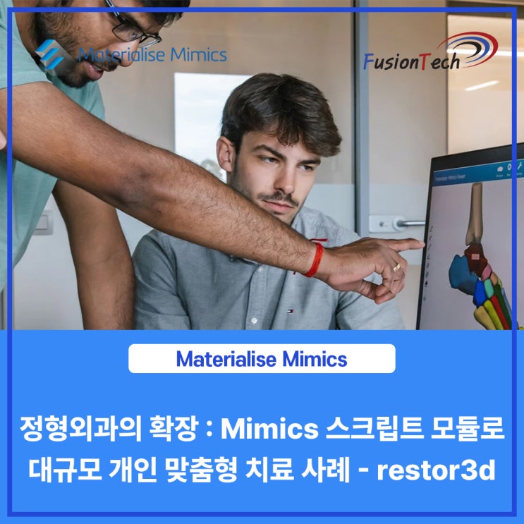  [Materialise S/W] 정형외과의 확장 : Mimics 스크립트 모듈로 대규모 개인 맞춤형 치료 사례 - restor3d