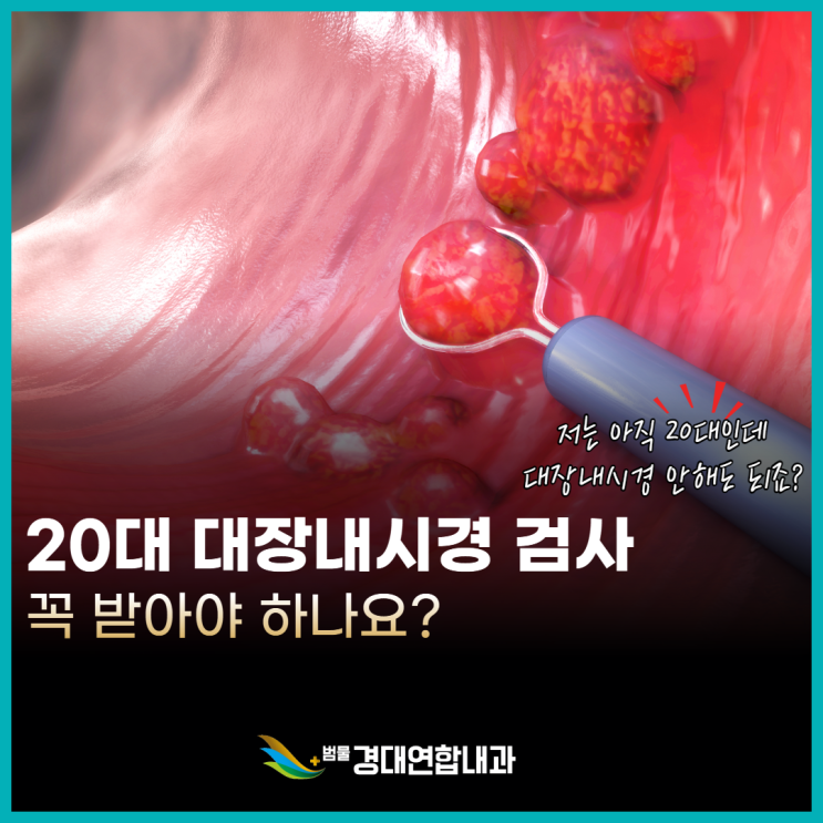  20대인데… 대장내시경 꼭 해야 하나요?