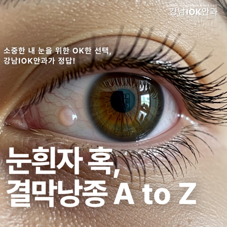  눈흰자 혹, 결막낭종 원인 치료 A to Z 총정리