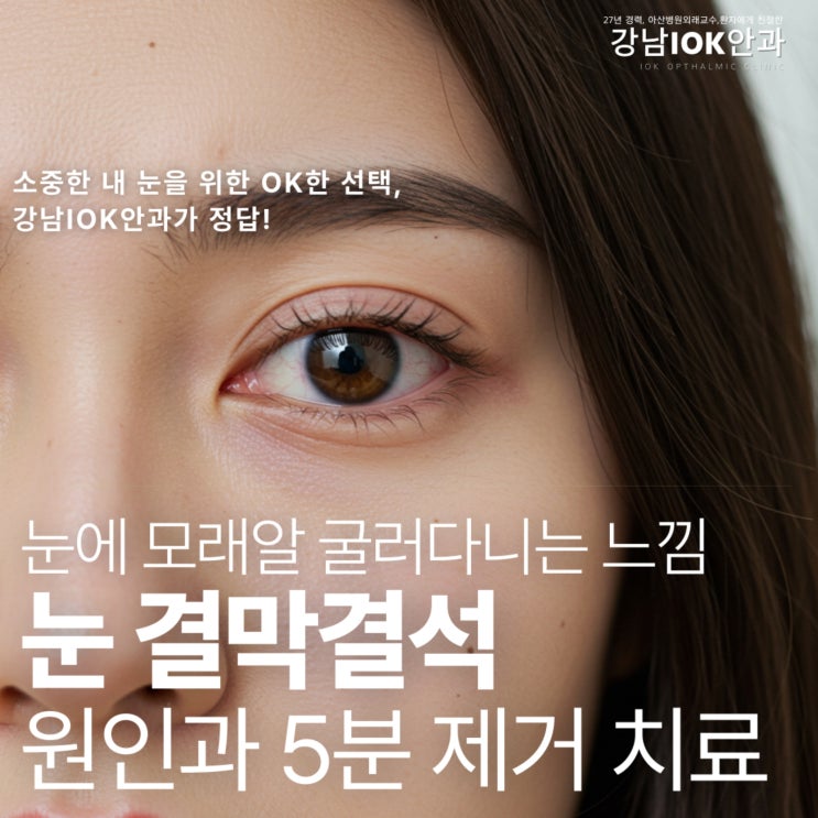  눈 결막결석 원인과 5분 제거 치료,눈에 모래알 굴러다니는 느낌, '이것' 때문입니다