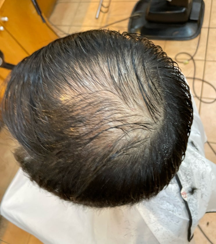 시니어탈모고민 부산사상르네시떼미용실 토탈탈모교정펌으로 멋진인생 시작! [ 괘법주례개금당감부암부전범일양정수영망미광안남천용호대연해운대광안리민락센텀양산울산거제김해명지녹산대저신호]