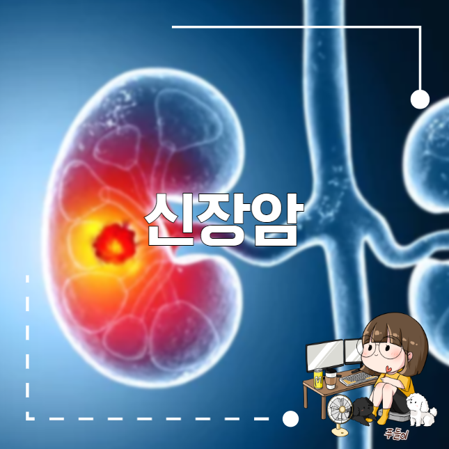 신장암 1기 4기 증상