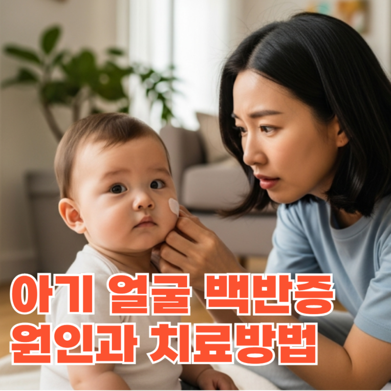 아기 얼굴 백반증 원인 및 초기 증상과 치료법