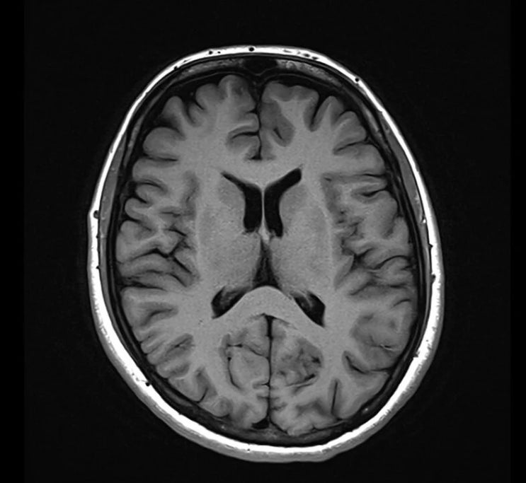  MRI 영상 뭐가 다른가요? 촬영 종류와 특징 알기 쉽게 정리!
