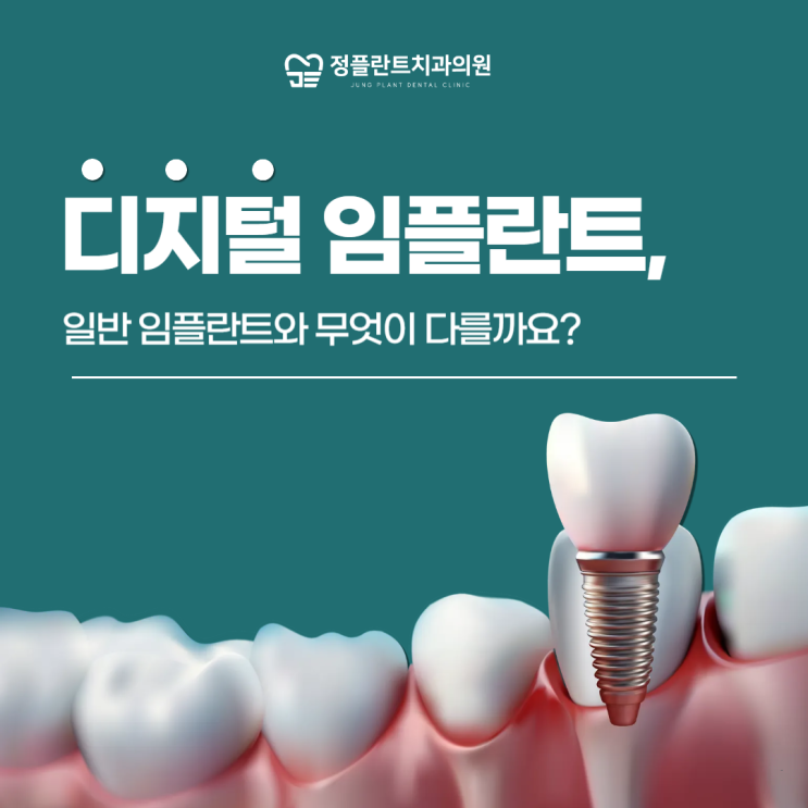  디지털 임플란트, 일반 임플란트와 무엇이 다를까요?