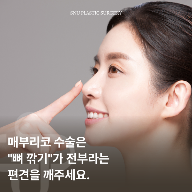  무보형물 매부리코 교정술, 어떤 경우에 적합한가?