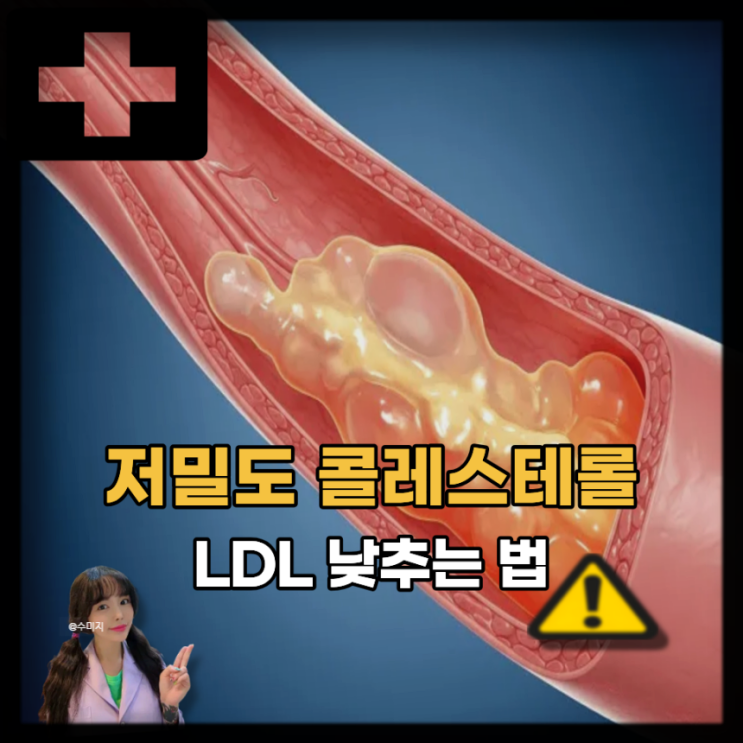  저밀도 콜레스테롤 정상 수치 낮추는 방법 음식 영양제