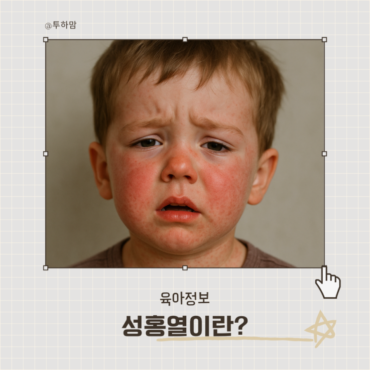  성홍열, 전염될까? 어린이집 보내도 되는지 알려드려요