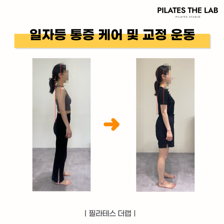  목동 필라테스 자고 일어났는데, 자주 담에 걸린다면? 일자등(Flat Back)을 의심해 보세요!