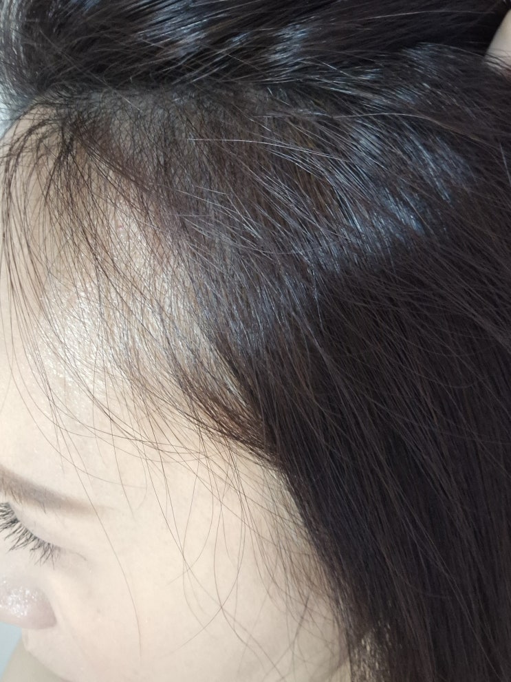  헤어라인 M자 고민? 스칼프메이크업 두피염색으로 자신감 회복!