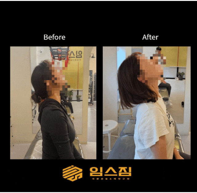 목디스크 통증 동탄 수술 후 재활운동 찐 후기