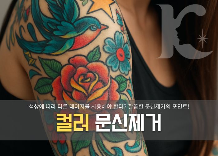  컬러 문신제거 색상에 따라 레이저가 달라야 한다