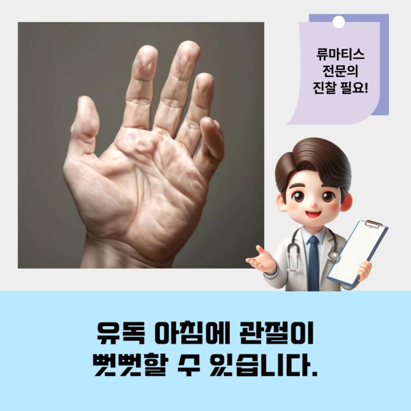 서울/인천 류마내과 류마티스관절염 증상과 원인 파악 방법