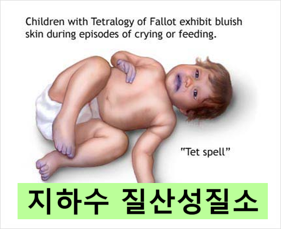  썩은물의 지표, 지하수 질산성질소 정수기 설치 및 주의사항, 충남 상업시설