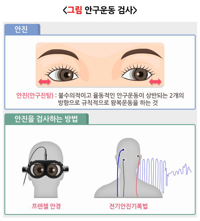 어지럼증의 원인, ‘이석증’과 ‘중추성 어지럼증’ 구분 필요