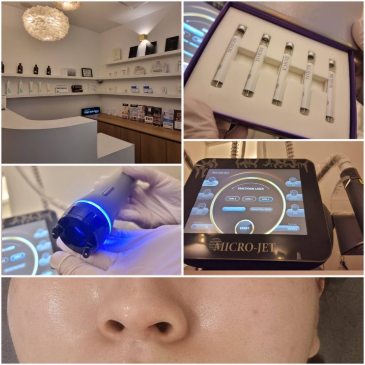  마곡윤곽관리 마곡역피부관리 데메테르 마이크로젯 BIOFOX 후기