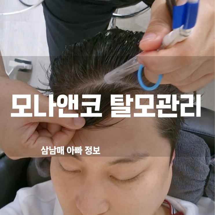  제주 탈모 관리 모나앤코! 두피 스케일링부터 앰플까지 완벽 케어 솔직 후기!
