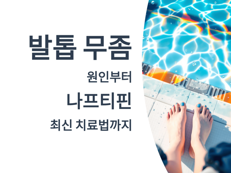  발톱 무좀 완벽 치료 가이드: 원인부터 나프티핀 최신 치료법까지